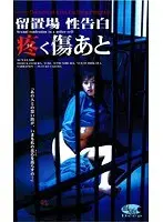 留置場 性告白 疼く傷あと