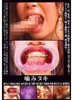噛みヌキ 歯フェラ・亀頭包茎噛み・歯茎発射・精子歯磨・開口器具・内視鏡・咀嚼・噛み合わせ・歯垢観察