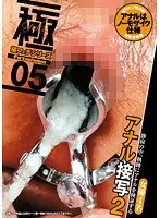 Extreme Fetish Series 05 Anal Closeup Shot 2