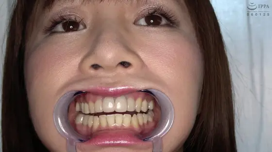 Teeth and Mouth Inspection, Iroha Narimiya