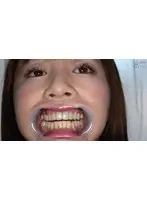 Teeth and Mouth Inspection, Iroha Narimiya