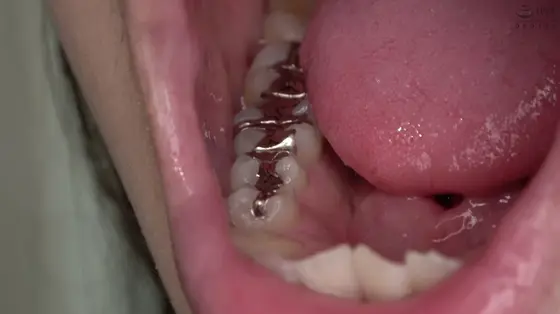 Teeth Fetish - Observation of the Teeth and the Uvula in the Mouth - Fuka Nagano