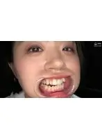 「激カワ人気女優の口内・歯・舌ベロ・のどちんこ観察！！！ 菊池はる