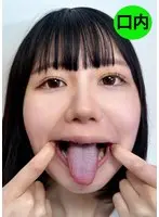 街角で声をかけて口内観察させてもらう テレビ局AD みゆりちゃん